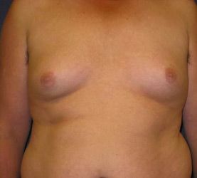 Image Before ALT content