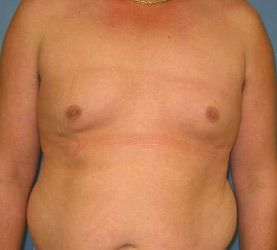 Image After ALT content