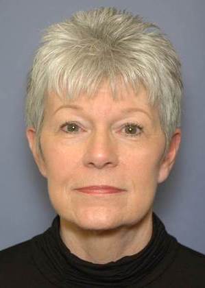 Image After ALT content